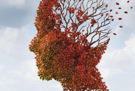 Artistic rendition of alzhiemers